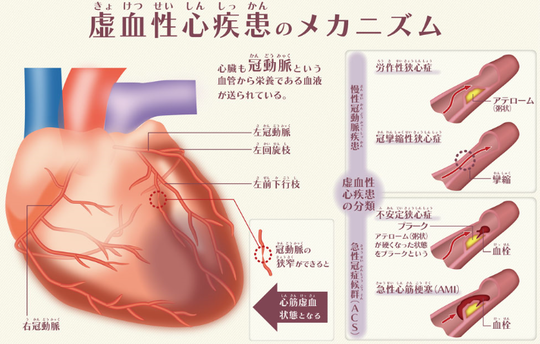 は と 血性 心 虚 疾患